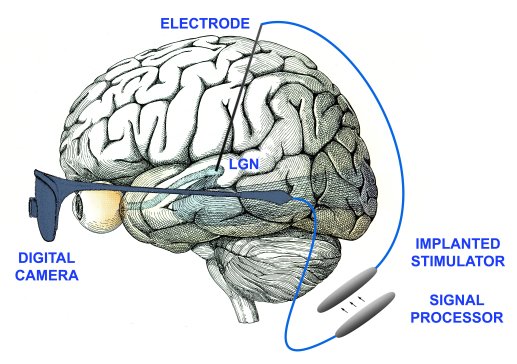 Pezaris Reid 2007 PNAS Illustration